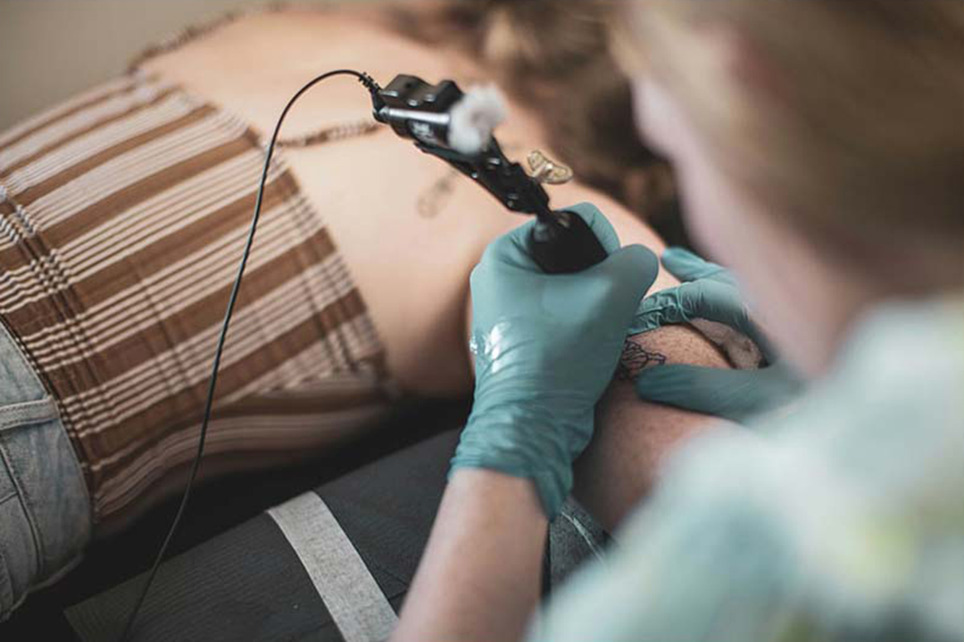 Tattoo regret? How to choose a removal service