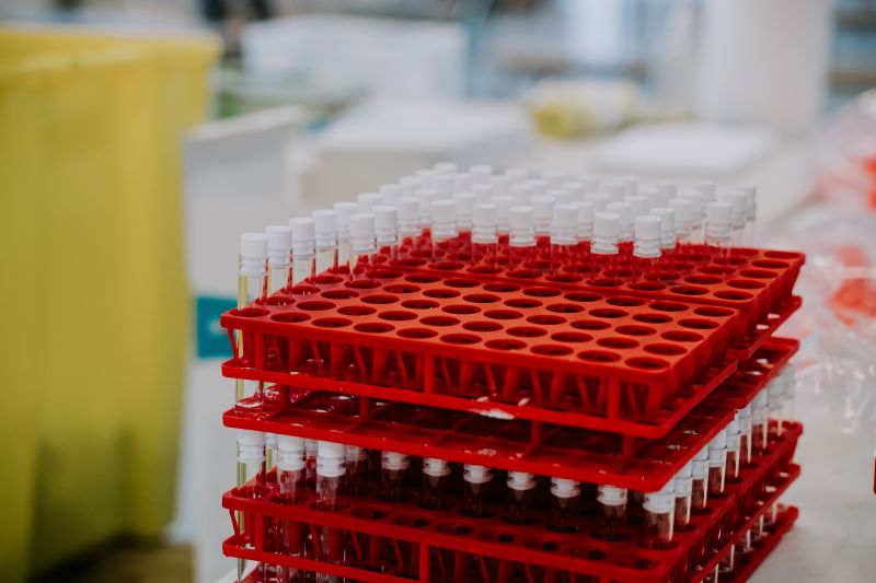 Test tubes for blood samples in a lab